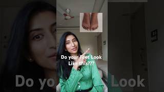 Dark And Patchy Feet? Solution