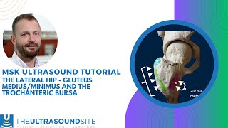 How To Ultrasound The Lateral Hip - Gluteus Medius And Minimus And The Trochanteric Bursa
