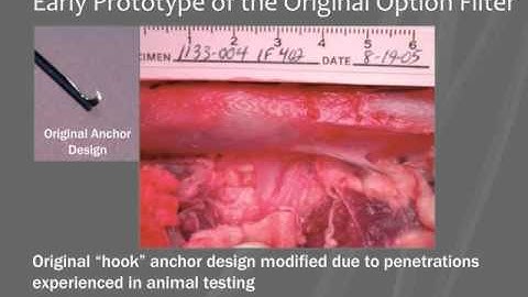 OptionELITE Presentation at CIRA 2014