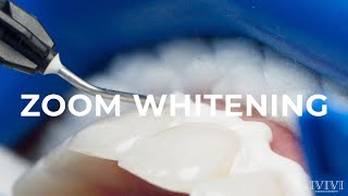 416 Dentistry | ZOOM WHITENING Step by Step Procedure and Before & After