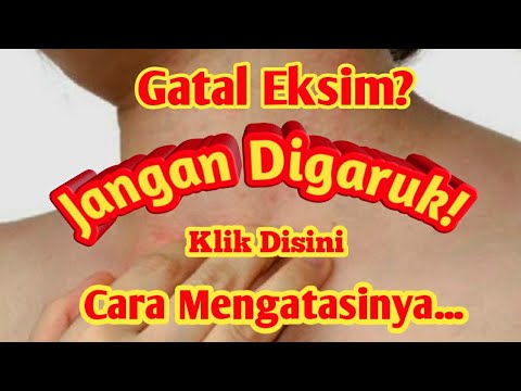 EKSIM KULIT ! Cara Mengobati Penyakit Kulit Eksim Dengan Cepat! Obat