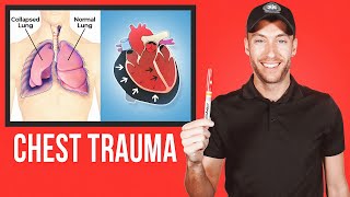 EASY Guide for CHEST TRAUMA