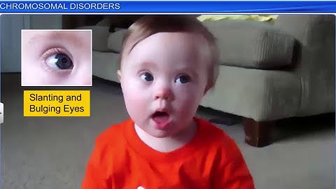 CBSE Class 12 Biology || Principles of Inheritance and Variation Part 1 || Full Chapter ||