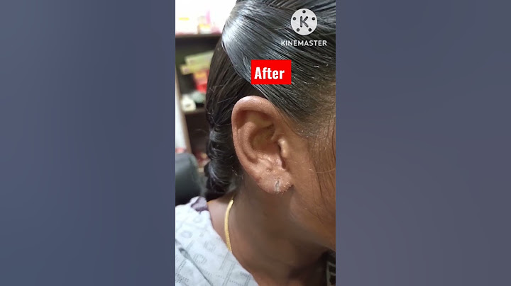 என்னது காது ஓட்டை அடைக்கப்பட்டதா😱 wow 💃💯#short #shortsvideo #salem #earlobe #easy #new #viral #vlog