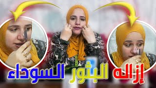 شوف اللى هيحصل عندما تضيف معجون الأسنان على الأنف - نتيجه غير متوقعه