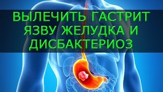 Эффективное лечение гастрита, язвы желудка и дисбактериоза. Симптомы и лечение язвы желудка и колита Эффективное лечение гастрита, язвы желудка и дисбактериоза. Симптомы и лечение язвы желудка и колита