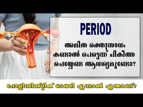 Is it necessary to seek immediate treatment for excessive bleeding? | Women's Health Problems