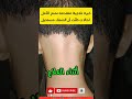 خبره علاجيه متميزه نمنح الأمل لحالات طنت أن الشفاء مستحيلWa Me 711045602 Wa Me 735168847 