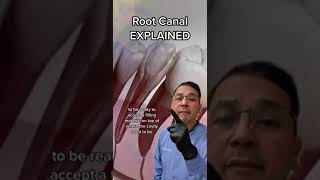 Root Canal Treatment EXPLAINED By Dentist | View Mobile Dental