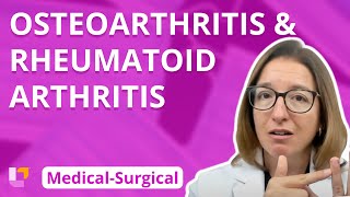 Osteoarthritis And Rheumatoid Arthritis - Medical-Surgical - Musculoskeletal System 