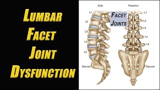 Dealing with Facet Arthropathy: 7 Tips for Getting Your Life Back