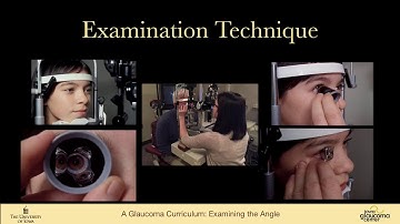 Examination of the angle. Gonioscopic techniques (UBM, AS-OCT)