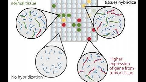 DNA Microarray Technology | Tumor tissue | Normal tissue