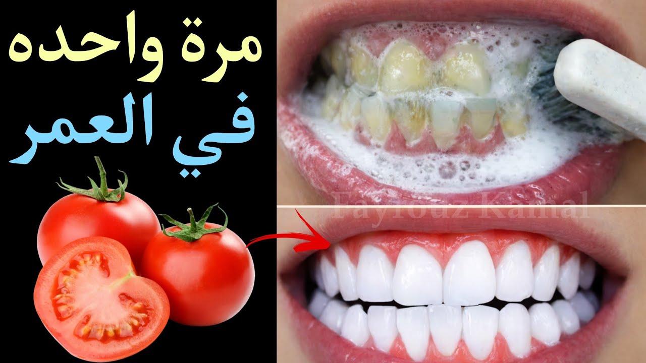 أقسم بالله ‼️ لن تحتاج للذهاب إلى طبيب الأسنان لتبييض الأسنان وإسقاط الجير ‼️ سيسقط لوحده بدون رجعة