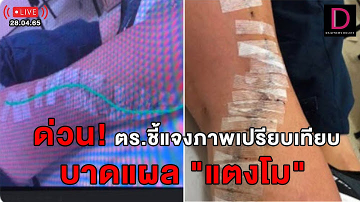 🔴LIVE ด่วน!ตร.ชี้แจงภาพเทียบบาดแผล #แตงโม หลังชาวเน็ตจับพิรุธไม่ได้เกิดจากใบพัดเรือ?  | เดลินิวส์