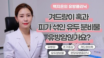 [백지은의 유방클리닉] 겨드랑이 혹과 피가 섞인 유두 분비물, 유방암인가요?