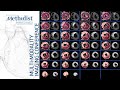 Heart Failure I: Evaluating Myocardial Viability (Zoghbi MD, Al-Mallah MD, Shah MD) January 4, 2022