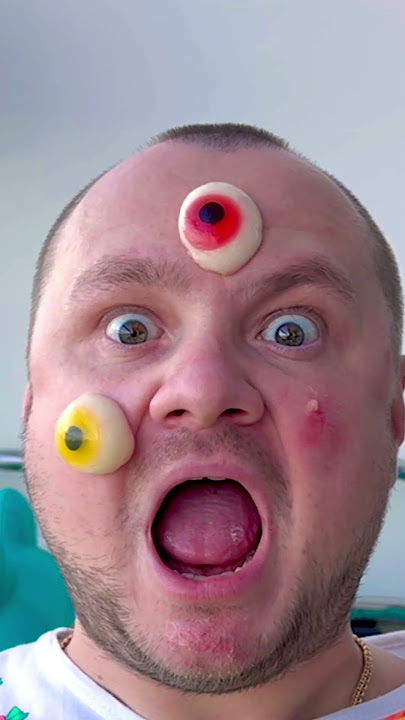 What ah oh with jelly eyball #funny #comedy #funnyfamily #shorts😁
