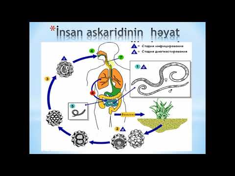 Video: Ürək Qurdları Haqqında 10 Mif