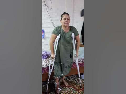 Перелом ноги. Таранная кость. аппарат Елизарова - YouTube