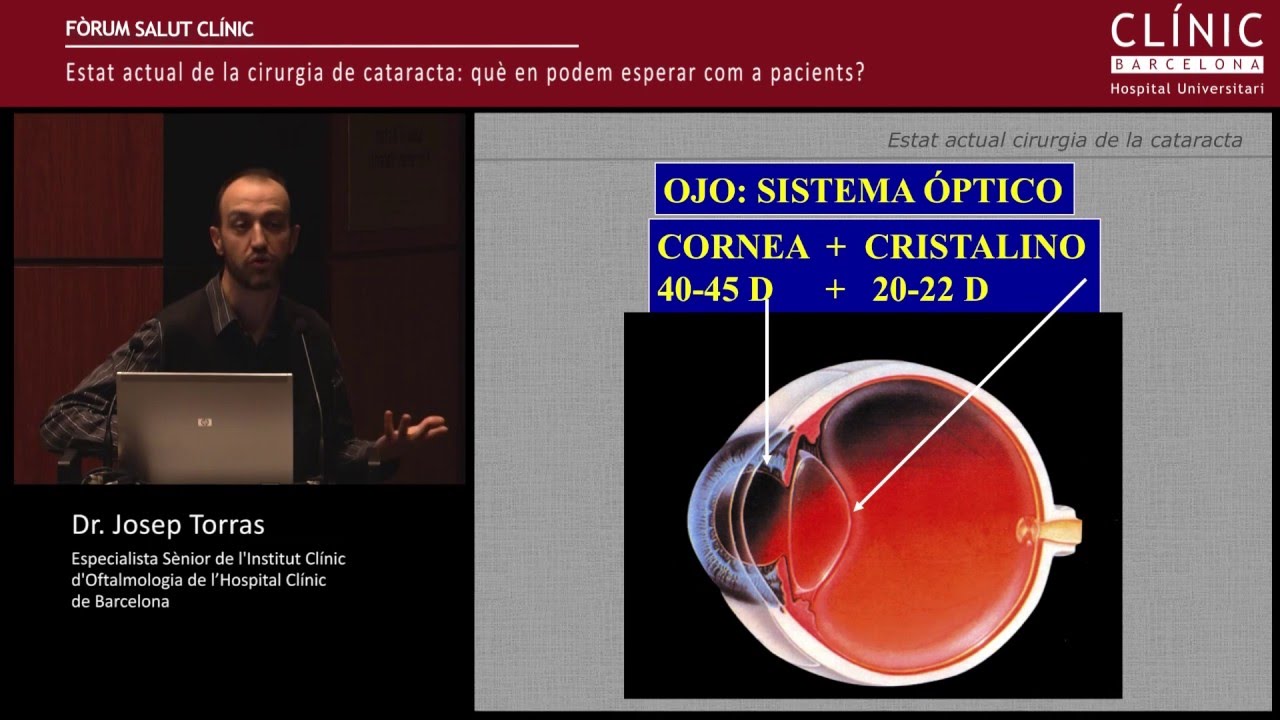 Fòrum Salut Clínic: "Estat actual de la cirurgia de cataracta" - Dr. Josep Torras