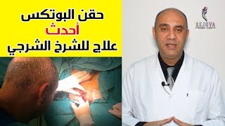 حقيقة حقن البوتكس لعلاج الشرخ الشرجي بدون جراحة ( شاهد فيديو للحقن + معلومات كاملة )