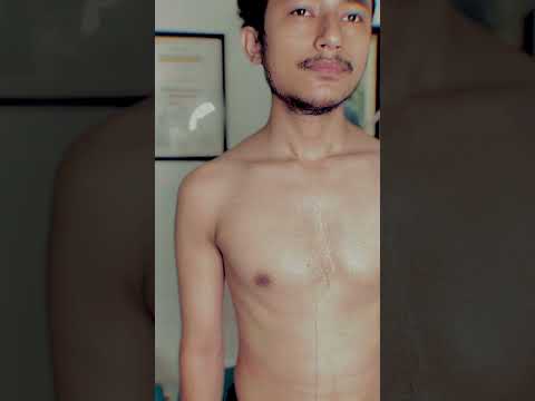 Uneven Shoulder Treatment