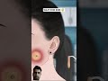 ASMR animation Face piercing removal treatment #asmr #animation #shortsvideo #trending