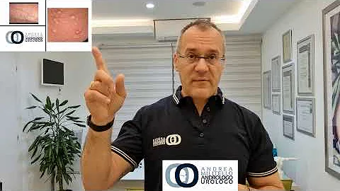 Cosa sono le palline bianche che si formano sulla cappella?