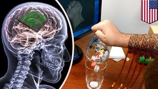 Medical breakthrough: Brain chip allows paralyzed man to regain hand movement - TomoNews
