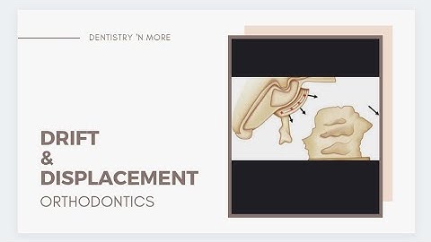 DRIFT vs DISPLACEMENT