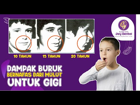 Video: 3 Cara Meringankan Batuk Kering dengan Rawatan Rumah