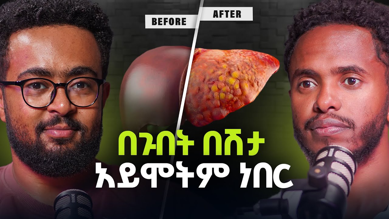 ጣፋጭ ነገሮች ጉበታችሁን እየገደለ ነው!  - ባህላዊ መድኃኒት መንፈሳዊ ነገር አይደለም  @ashuviews Ashu #21