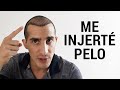 Me injerté pelo | Mitos y realidades | Rommel Pacheco