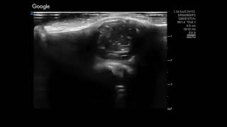 Cysts (3\/5)