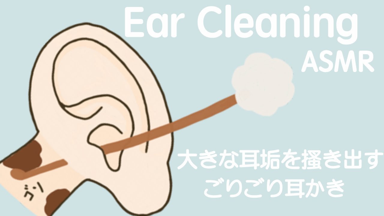 【ASMR】大きな耳垢を搔き出すごりごり耳かきEar Cleaning 【No Talking】