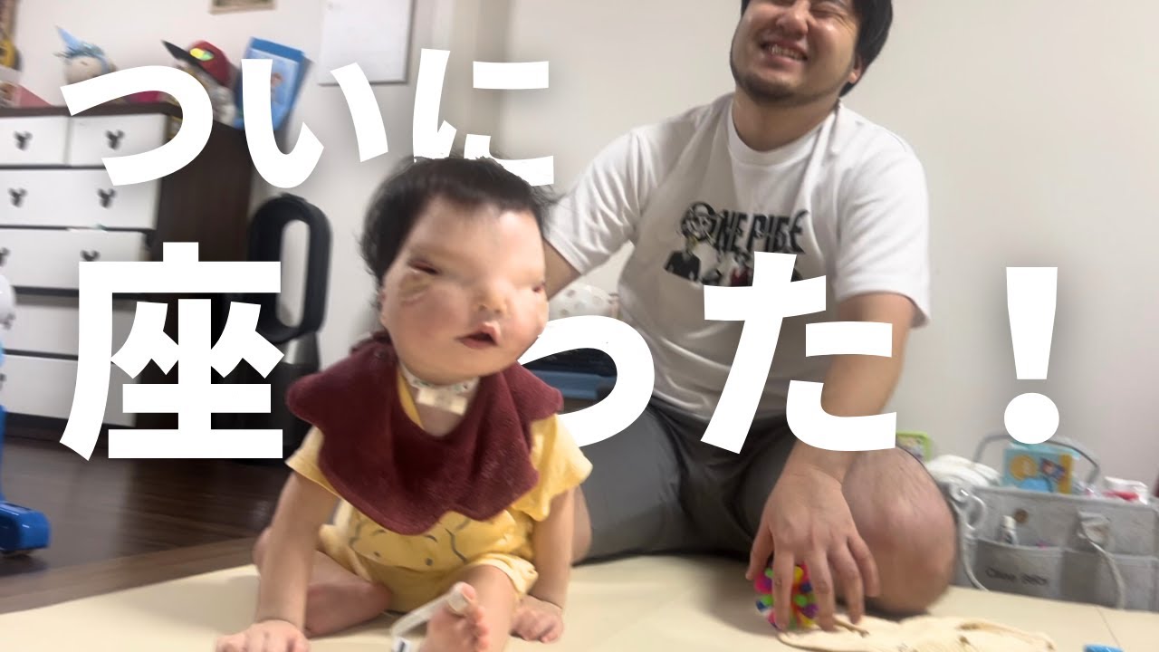 He can sit up!] You worked hard on your rehabilitation, Omochi-kun