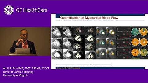 Leveraging Deep Learning Solutions to Move Towards a 20 Minute Stress CMR Exam