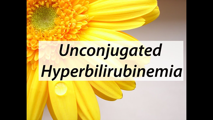 Unconjugated Hyperbilirubinemia