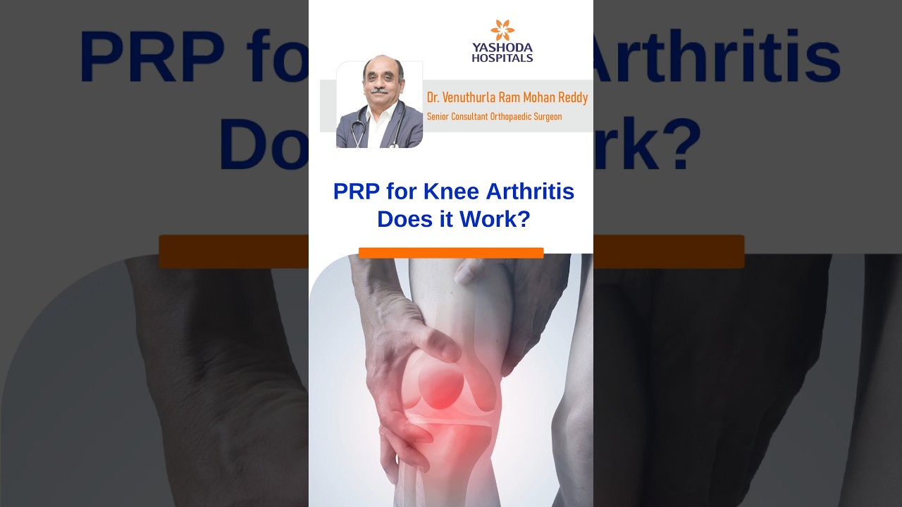 PRP Therapy for Knee Arthritis: A Promising Solution for Pain Relief and Healing