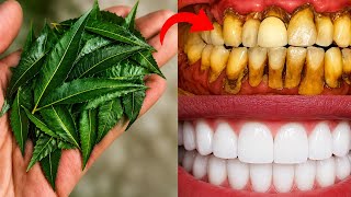Teeth Whitening Remedy | How to Whiten Yellow Teeth? पीले दांतों को मोती जैसे चमकाएं #teethwhitening