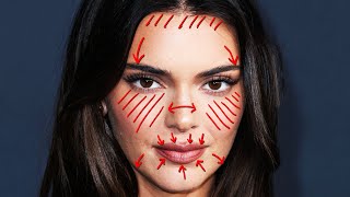 Removing KENDALL JENNER'S Plastic Surgery