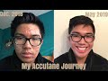 My Accutane Journey in 5 minutes