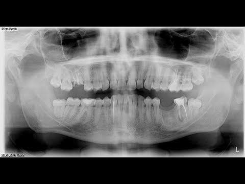 Смотреть клип Рунарок в клубе Смотреть клип Рунарок в клубе