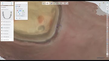Sculpt Your Scan Prior to 3shape Automate Design