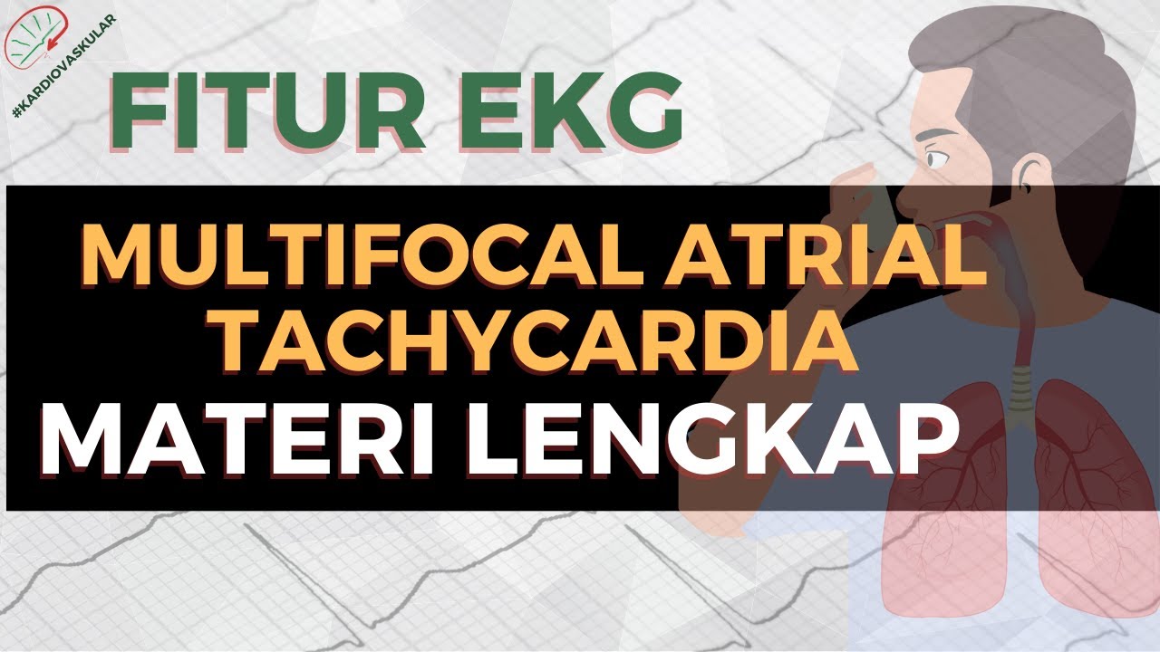 MULTIFOCAL ATRIAL TACHYCARDIA