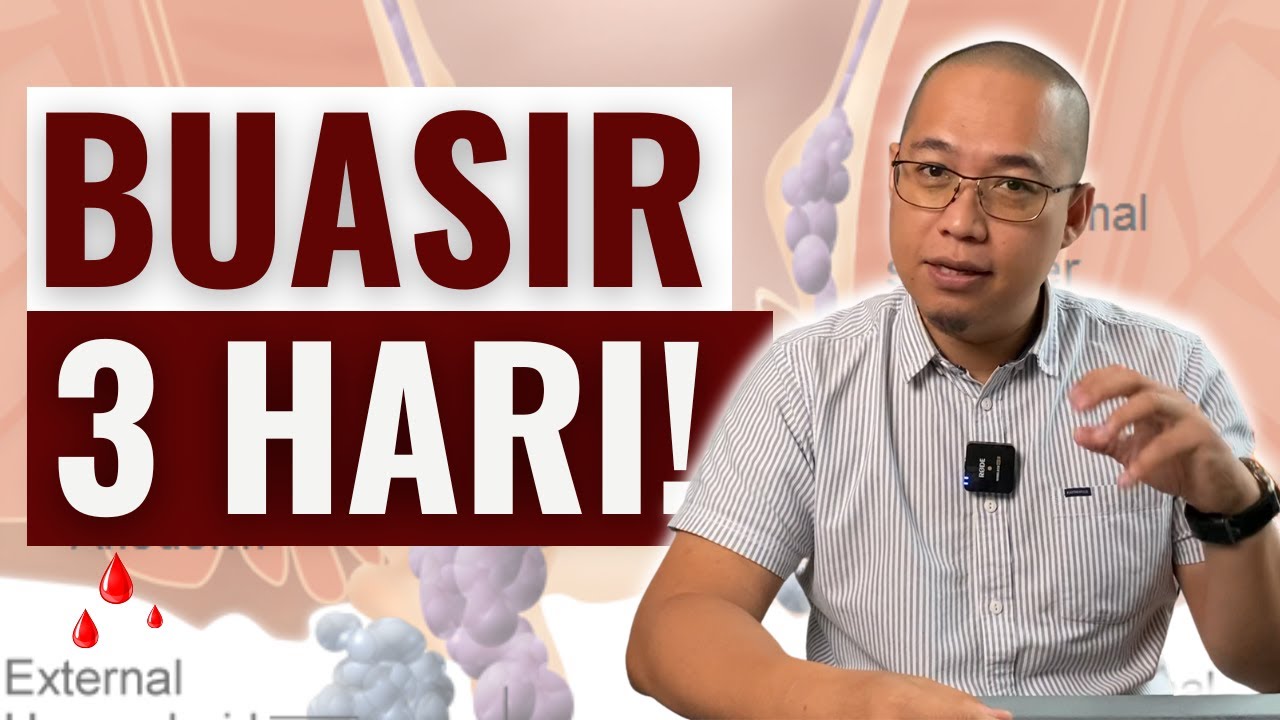 3 Cara Atasi Masalah Buasir Dalam 3 Hari Sahaja