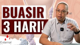 3 Cara Atasi Masalah Buasir Dalam 3 Hari Sahaja 3 Cara Atasi Masalah Buasir Dalam 3 Hari Sahaja