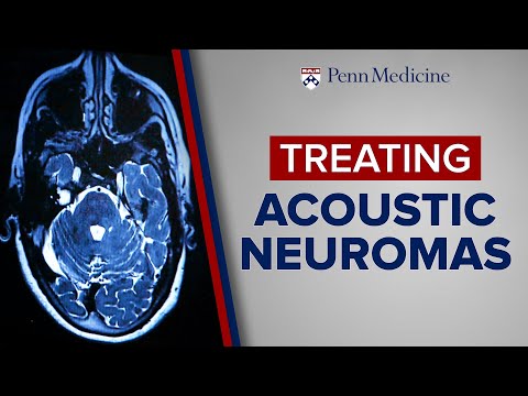 Treating Acoustic Neuromas at Penn Medicine