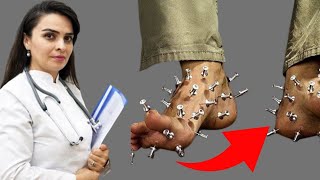 Qicolmalar - Səbəbləri Nədir Və İlk Yardim Necə Olmalıdır?